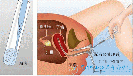 活跃!人工助孕费用合家欢乐